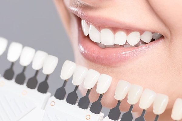 Здоровье зубов: важность ухода и методы сохранения блестящей улыбки